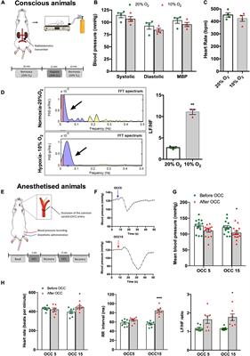 Blood Pressure Regulation by the Carotid Sinus Nerve: Clinical Implications for Carotid Body Neuromodulation